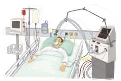 Patient sur un lit d'hôpital branché sur un appareil respiratoire